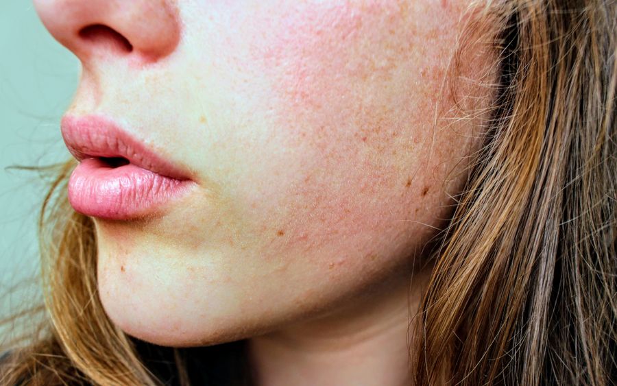 Bem-estar e naturalidade — Rinomodelação na Clínica Sensitivity, Osasco