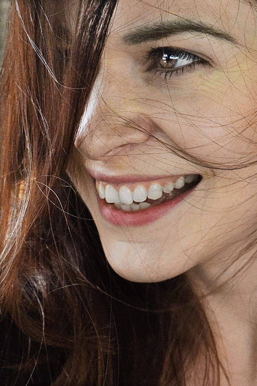 Bem-estar e naturalidade — Implantes Dentários na Clínica Sensitivity, Osasco